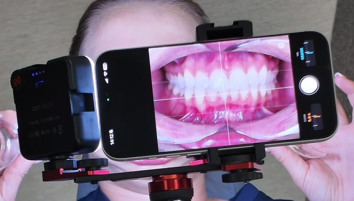 DentalCamApp video presentation