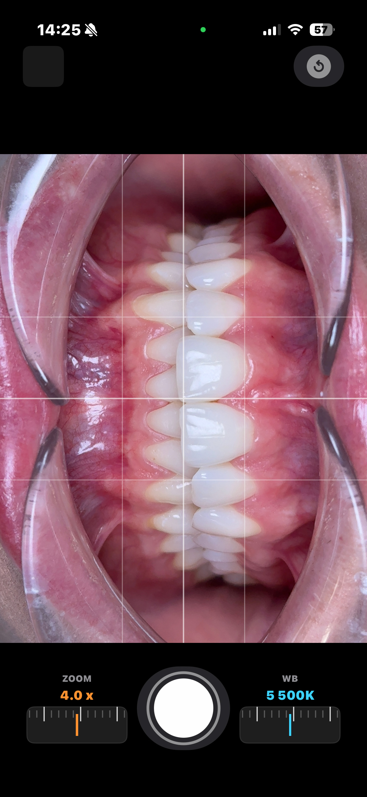 DentalCamApp UI